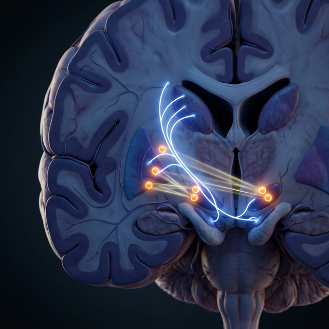 Brain circuit diagram showing SMA stimulation for Parkinson's motor improvement